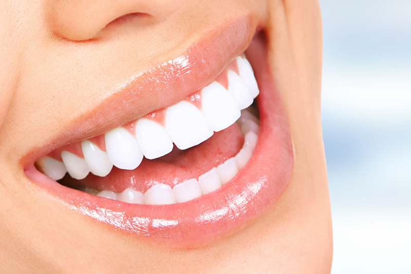 Cosmetic Dentistry in Milpitas